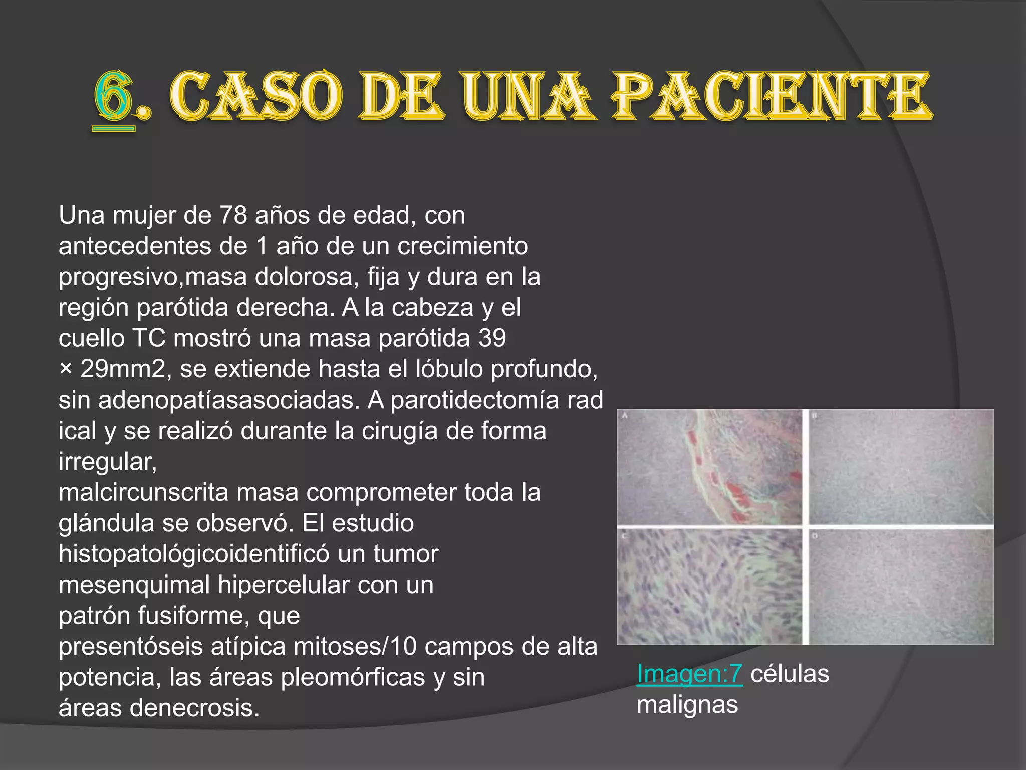 Una mujer de 78 años de edad, con
antecedentes de 1 año de un crecimiento
progresivo,masa dolorosa, fija y dura en la
región parótida derecha. A la cabeza y el
cuello TC mostró una masa parótida 39
× 29mm2, se extiende hasta el lóbulo profundo,
sin adenopatíasasociadas. A parotidectomía rad
ical y se realizó durante la cirugía de forma
irregular,
malcircunscrita masa comprometer toda la
glándula se observó. El estudio
histopatológicoidentificó un tumor
mesenquimal hipercelular con un
patrón fusiforme, que
presentóseis atípica mitoses/10 campos de alta
potencia, las áreas pleomórficas y sin           Imagen:7 células
áreas denecrosis.                                malignas
 