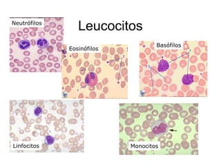 LeucocitosNeutrófilos
Eosinófilos
Basófilos
Linfocitos Monocitos
 