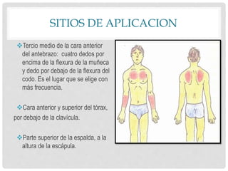 SITIOS DE APLICACION
Tercio medio de la cara anterior
del antebrazo: cuatro dedos por
encima de la flexura de la muñeca
y dedo por debajo de la flexura del
codo. Es el lugar que se elige con
más frecuencia.
Cara anterior y superior del tórax,
por debajo de la clavícula.
Parte superior de la espalda, a la
altura de la escápula.
 