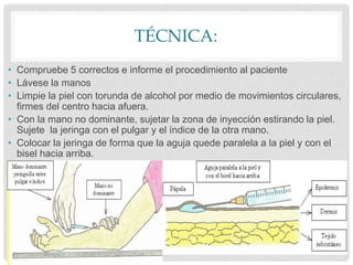 TÉCNICA:
• Compruebe 5 correctos e informe el procedimiento al paciente
• Lávese la manos
• Limpie la piel con torunda de alcohol por medio de movimientos circulares,
firmes del centro hacia afuera.
• Con la mano no dominante, sujetar la zona de inyección estirando la piel.
Sujete la jeringa con el pulgar y el índice de la otra mano.
• Colocar la jeringa de forma que la aguja quede paralela a la piel y con el
bisel hacia arriba.
 