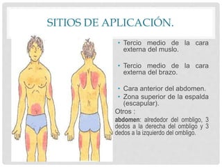 SITIOS DE APLICACIÓN.
• Tercio medio de la cara
externa del muslo.
• Tercio medio de la cara
externa del brazo.
• Cara anterior del abdomen.
• Zona superior de la espalda
(escapular).
Otros :
abdomen: alrededor del ombligo, 3
dedos a la derecha del ombligo y 3
dedos a la izquierdo del ombligo.
 