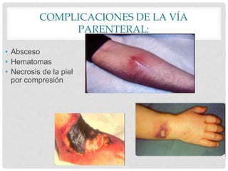 COMPLICACIONES DE LA VÍA
PARENTERAL:
• Absceso
• Hematomas
• Necrosis de la piel
por compresión
 