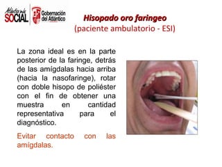 Hisopado oro faringeo
(paciente ambulatorio - ESI)
La zona ideal es en la parte
posterior de la faringe, detrás
de las amígdalas hacia arriba
(hacia la nasofaringe), rotar
con doble hisopo de poliéster
con el fin de obtener una
muestra
en
cantidad
representativa
para
el
diagnóstico.
Evitar contacto
amígdalas.

con

las

 