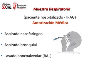Muestra Respiratoria
(paciente hospitalizado - IRAG)
Autorización Médica
• Aspirado nasofaringeo
• Aspirado bronquial
• Lavado boncoalveolar (BAL)

 