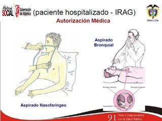 Presentacion irag