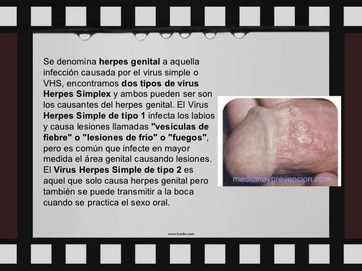 Enfermedades De Transmision Sexual Metodos Anticonceptivos Y Aborto