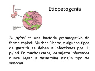 Etiopatogenia 
H. pylori es una bacteria gramnegativa de 
forma espiral. Muchas úlceras y algunos tipos 
de gastritis se deben a infecciones por H. 
pylori. En muchos casos, los sujetos infectados 
nunca llegan a desarrollar ningún tipo de 
síntoma. 
 