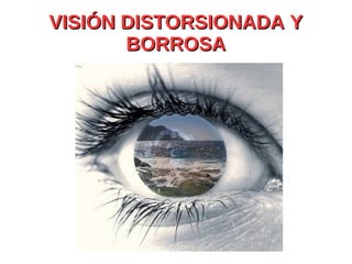 VISIÓN DISTORSIONADA Y BORROSA 