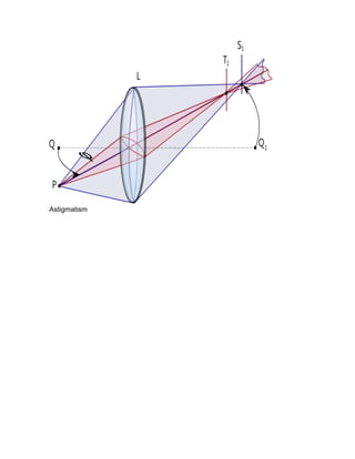 Astigmatism

 