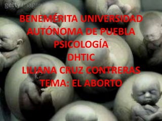 BENEMÉRITA UNIVERSIDAD
AUTÓNOMA DE PUEBLA
PSICOLOGÍA
DHTIC
LILIANA CRUZ CONTRERAS
TEMA: EL ABORTO
 
