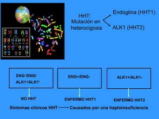 La telangiectasia Hemorrágica Hereditaria (RENDU OSLER WEBER): una ...