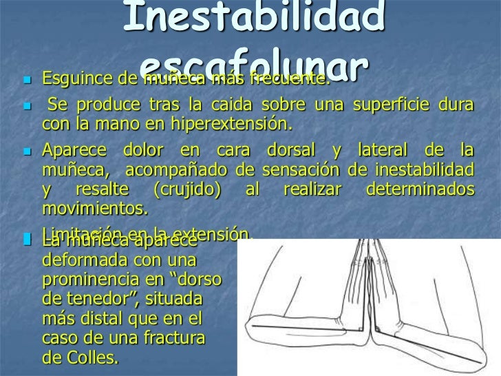 Duele entre el cuello y la clavícula