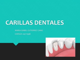 CARILLAS DENTALES
MARIA ISABEL GUTIERREZ CANO
CODIGO: 04171998
 