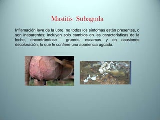 Mastitis Subaguda
Inflamación leve de la ubre, no todos los síntomas están presentes, o
son inaparentes; incluyen solo cambios en las características de la
leche, encontrándose
grumos, escamas y en ocasiones
decoloración, lo que le confiere una apariencia aguada.

 