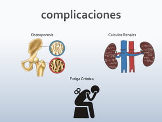 Osteoporosis Calculos Renales
Fatiga Crónica
 
