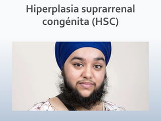 Tiroides, paratiroides, Glandulas suprarenales