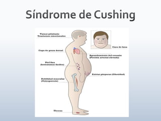 Tiroides, paratiroides, Glandulas suprarenales