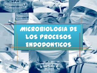 MICROBIOLOGIA DE
 LOS PROCESOS
 ENDODONTICOS
 