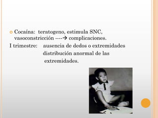  Cocaína: teratogeno, estimula SNC,
   vasoconstricción ---- complicaciones.
I trimestre: ausencia de dedos o extremidades
               distribución anormal de las
               extremidades.
 