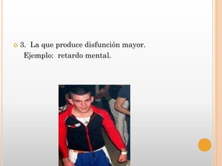    3. La que produce disfunción mayor.
     Ejemplo: retardo mental.
 