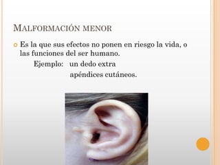MALFORMACIÓN MENOR
   Es la que sus efectos no ponen en riesgo la vida, o
    las funciones del ser humano.
         Ejemplo: un dedo extra
                   apéndices cutáneos.
 