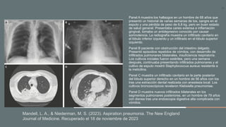 Neumonía por aspiración y neumonitis.pptx