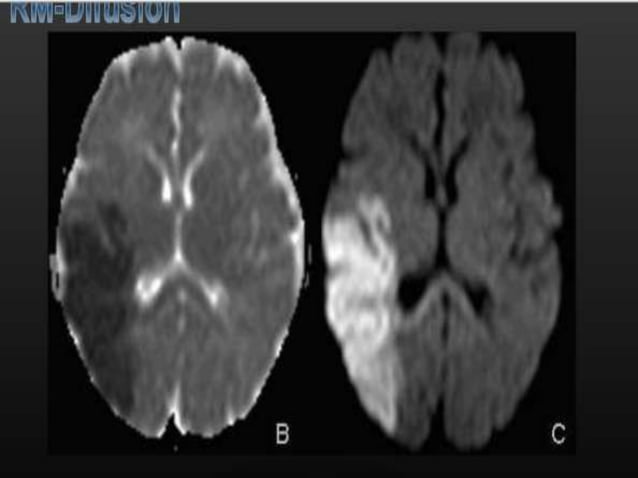 Presentacion Neuroradiologia