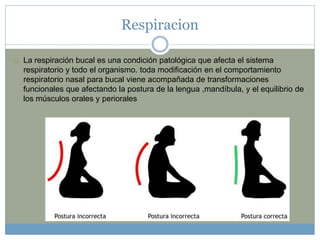 Respiracion 
La respiración bucal es una condición patológica que afecta el sistema 
respiratorio y todo el organismo. toda modificación en el comportamiento 
respiratorio nasal para bucal viene acompañada de transformaciones 
funcionales que afectando la postura de la lengua ,mandíbula, y el equilibrio de 
los músculos orales y periorales 
 