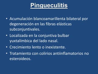 Colirio con antiinflamatorios no esteroideos.