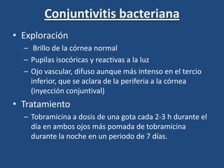 Conjuntivitis bacteriana Exploración Brillo de la córnea normal