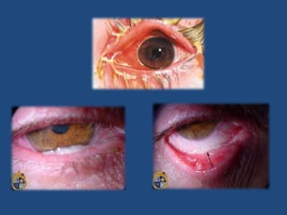 Pupilas isocóricas y reactivas a la luz