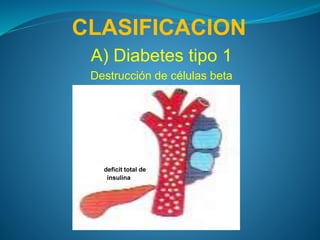 CLASIFICACION
A) Diabetes tipo 1
Destrucción de células beta
No deficit total de
insulina
 