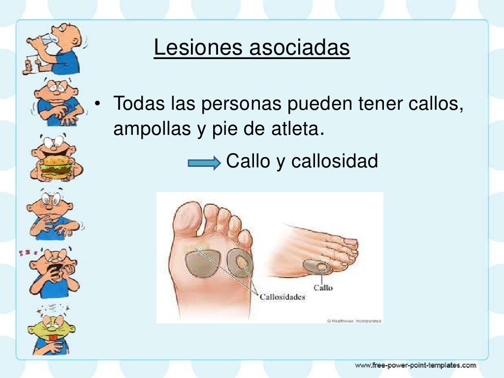 Cuidados de enfermería en pie diabetico