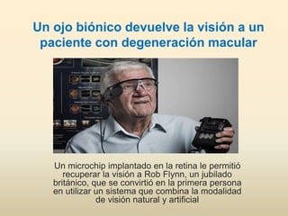 Un ojo biónico devuelve la visión a un
paciente con degeneración macular
Un microchip implantado en la retina le permitió
recuperar la visión a Rob Flynn, un jubilado
británico, que se convirtió en la primera persona
en utilizar un sistema que combina la modalidad
de visión natural y artificial
 