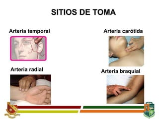 SITIOS DE TOMA
Arteria temporal Arteria carótida
Arteria radial Arteria braquial
 