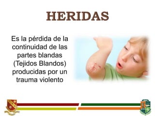 Es la pérdida de la
continuidad de las
partes blandas
(Tejidos Blandos)
producidas por un
trauma violento
 