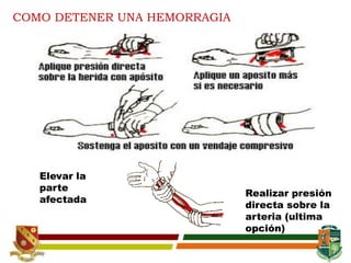 COMO DETENER UNA HEMORRAGIA
Elevar la
parte
afectada
Realizar presión
directa sobre la
arteria (ultima
opción)
 