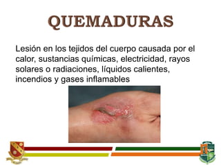 Lesión en los tejidos del cuerpo causada por el
calor, sustancias químicas, electricidad, rayos
solares o radiaciones, líquidos calientes,
incendios y gases inflamables
 
