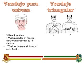 - Utilizar 2 vendas.
- 1 Vuelta circular en sentido
horizontal alrededor de la
cabeza.
- 2 Vueltas circulares iniciando
en la frente.
 