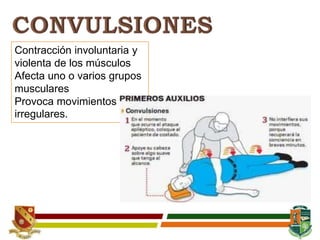 Contracción involuntaria y
violenta de los músculos
Afecta uno o varios grupos
musculares
Provoca movimientos
irregulares.
 