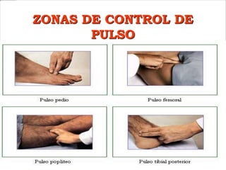 LIC.CARMEN LUISA
ESCOBAR ASTRELLI
ZONAS DE CONTROL DE
PULSO
 