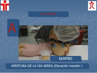 APERTURA DE LA VIA AEREA (Elevación mentón )
A
VIA AEREA
OLFATEO
 