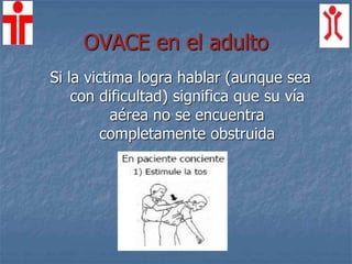 OVACE en el adulto
Si la victima logra hablar (aunque sea
con dificultad) significa que su vía
aérea no se encuentra
completamente obstruida
 