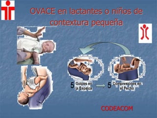 OVACE en lactantes o niños de
contextura pequeña
CODEACOM
 