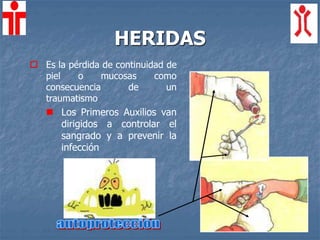 HERIDAS
 Es la pérdida de continuidad de
piel o mucosas como
consecuencia de un
traumatismo
 Los Primeros Auxilios van
dirigidos a controlar el
sangrado y a prevenir la
infección
 