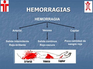 HEMORRAGIAS
HEMORRAGIA
Arterial Venosa Capilar
Salida intermitente
Rojo-brillante
Salida continua
Rojo-oscura
Poca cantidad de
sangre roja
 