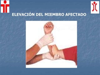 ELEVACIÓN DEL MIEMBRO AFECTADO
 