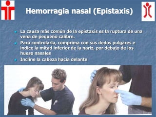 Hemorragia nasal (Epistaxis)
 La causa más común de la epistaxis es la ruptura de una
vena de pequeño calibre.
 Para controlarla, comprima con sus dedos pulgares e
índice la mitad inferior de la nariz, por debajo de los
hueso nasales
 Incline la cabeza hacia delante
 