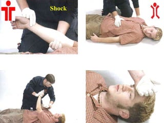 Shock
1. Aumento de la Frecuencia. Cardiaca 2. Aumento de la Frecuencia. Respiratoria
3. Excitación 4. Piel fría, pálida, sudorosa
 