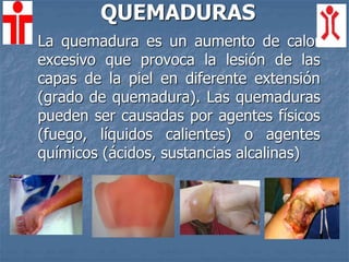QUEMADURAS
La quemadura es un aumento de calor
excesivo que provoca la lesión de las
capas de la piel en diferente extensión
(grado de quemadura). Las quemaduras
pueden ser causadas por agentes físicos
(fuego, líquidos calientes) o agentes
químicos (ácidos, sustancias alcalinas)
 